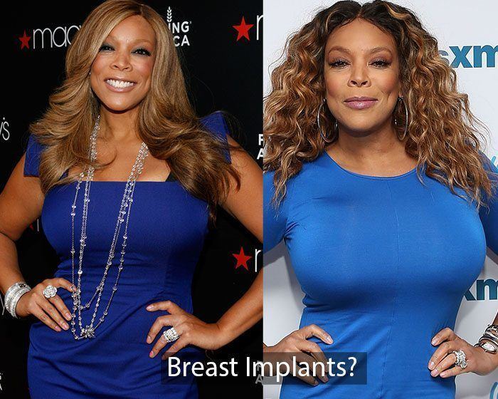 Tittys wendy williams Wendy WIlliams'