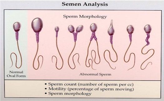 Why is my sperm so thick